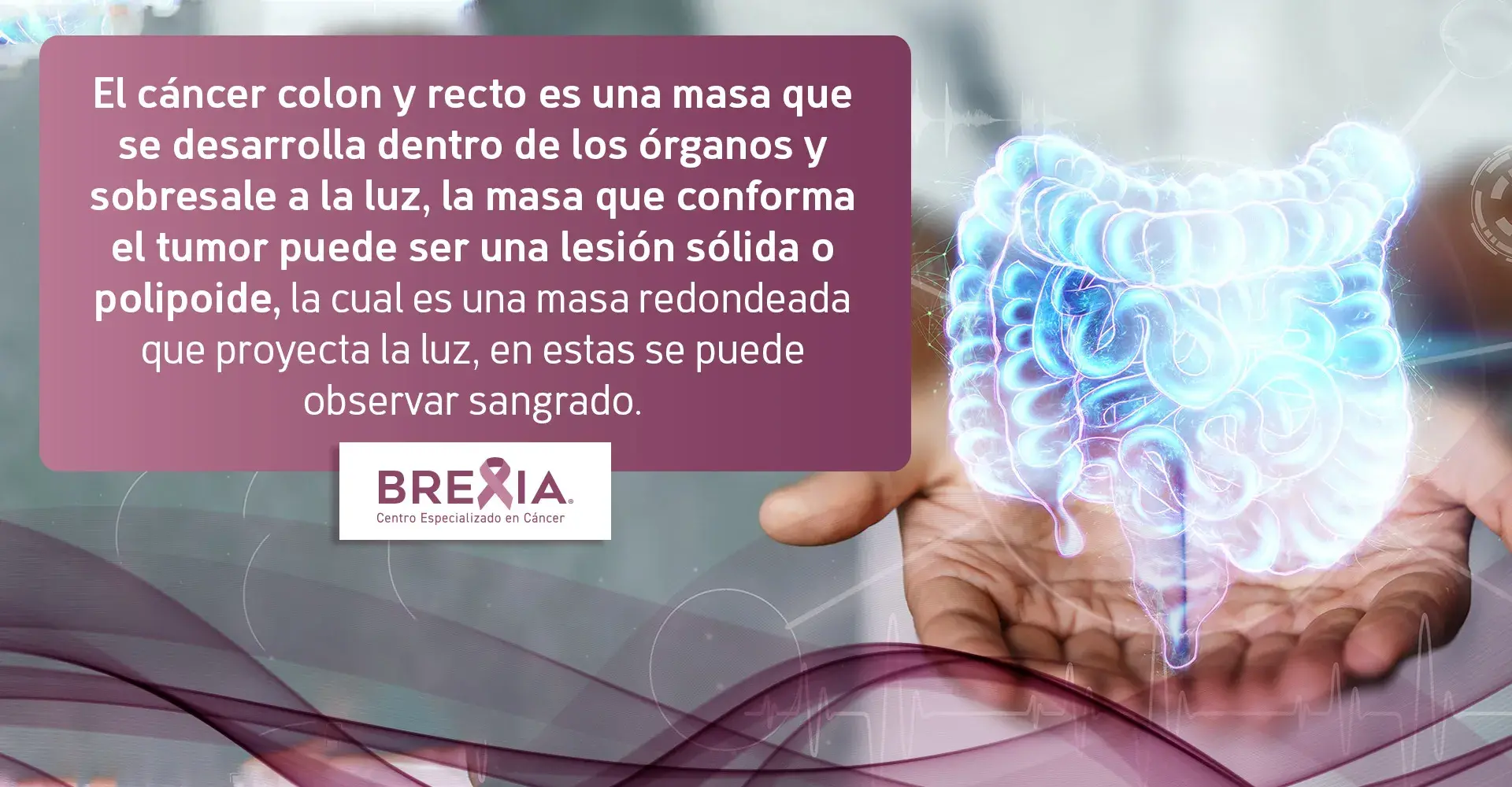 lesiones cáncer de colon y recto lesiones del cáncer de colon y recto