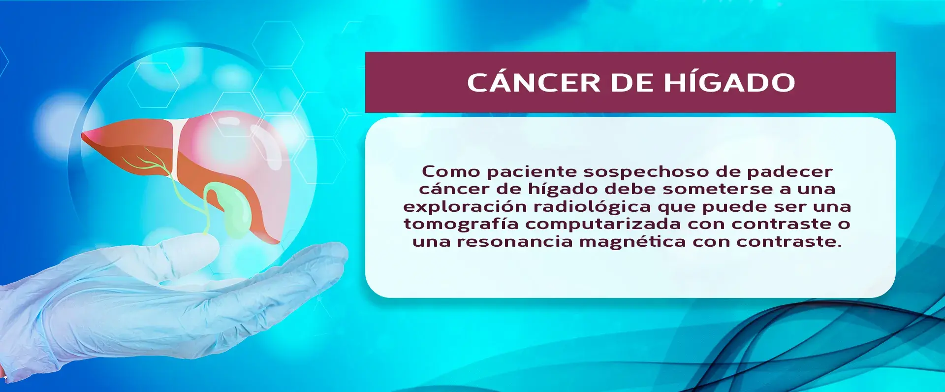 pruebas del cáncer de hígado La tomografía computarizada con contraste o la resonancia magnética son las pruebas para saber si se padece de cáncer de hígado