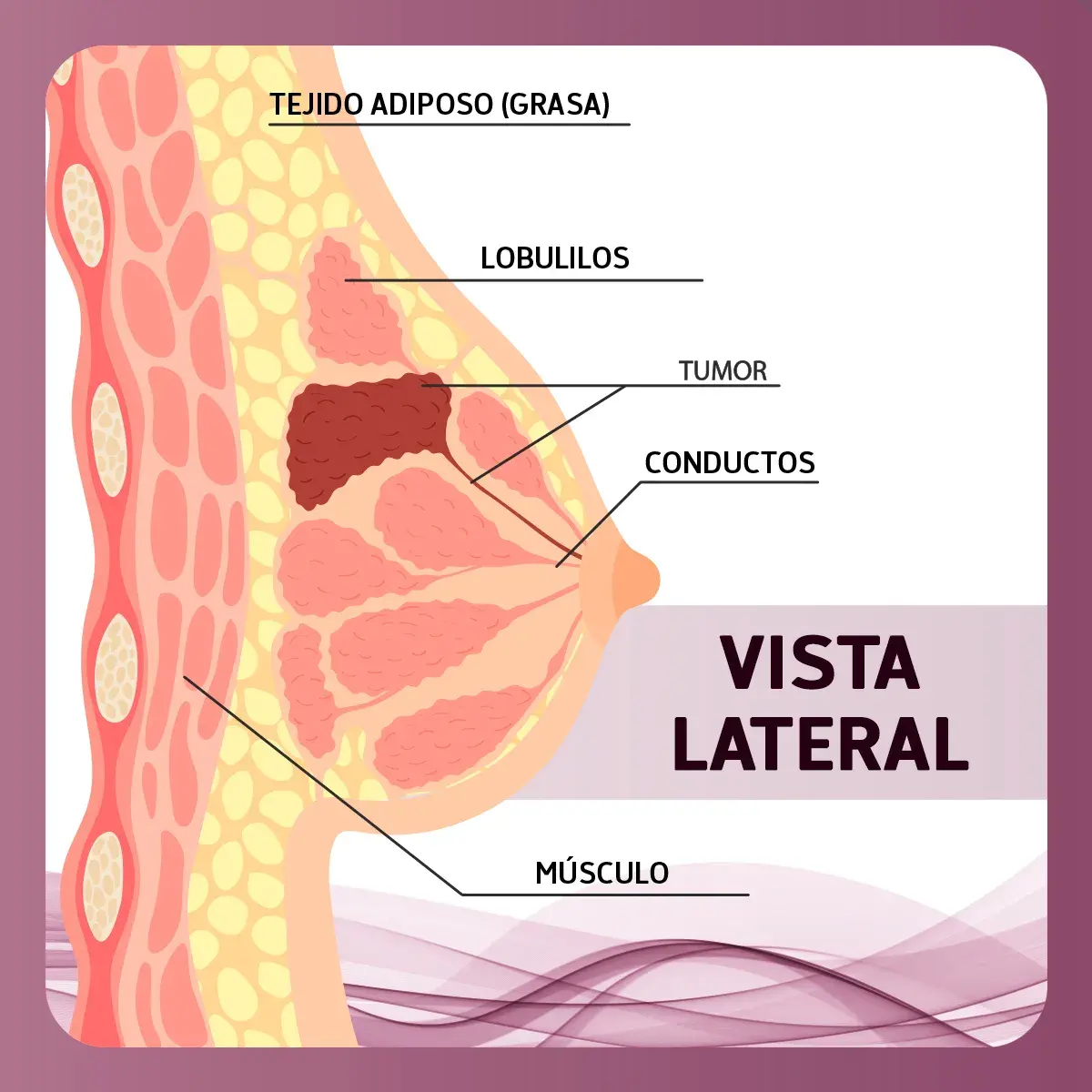 anotomía de las mamas Vista de la anatomía de la mama (músculo, tejido adiposo, conductos, lobulillos)