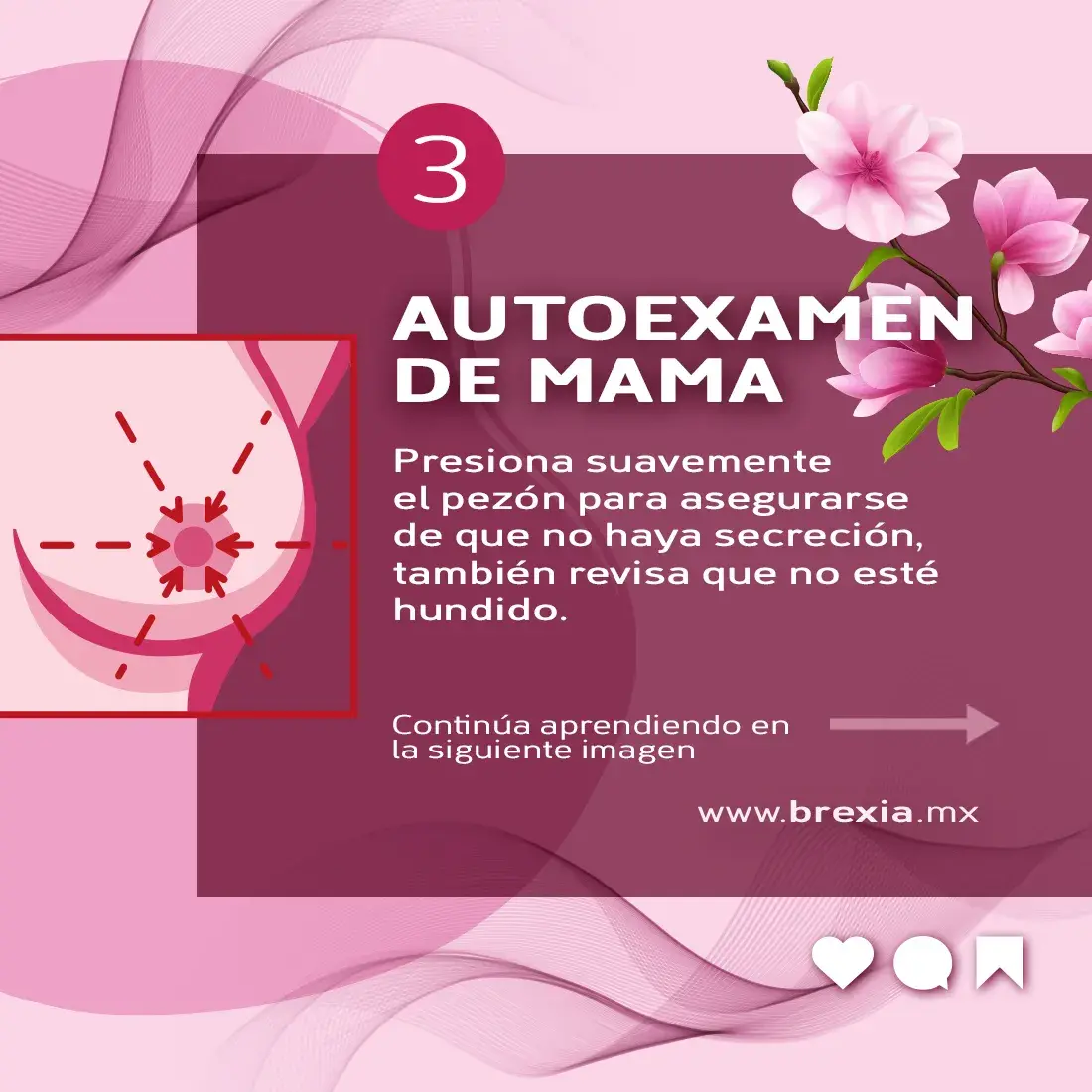 Revisar pezones para encontrar anomalías Revisar pezones para encontrar anomalías