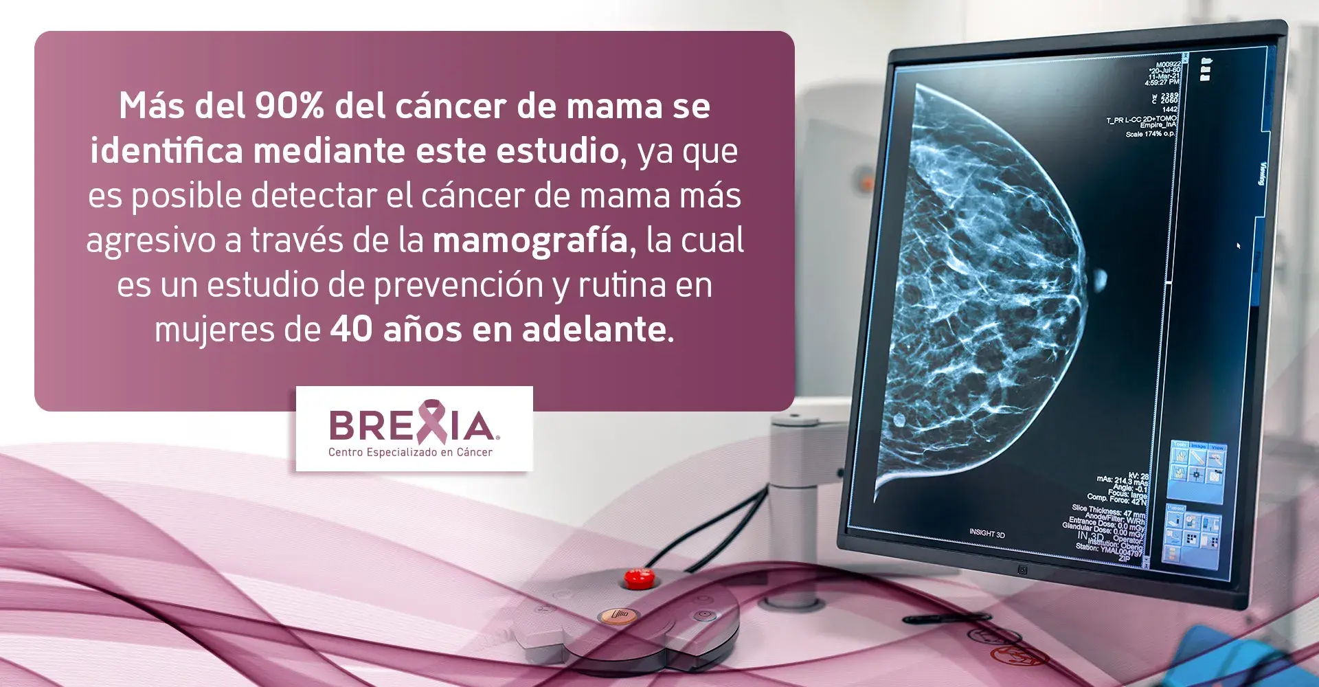 Prueba diagnóstica mamografía para cáncer de mama Mediante la mamografía, prueba diagnóstica de imagen, se identifica 90 % del cáncer de mama.