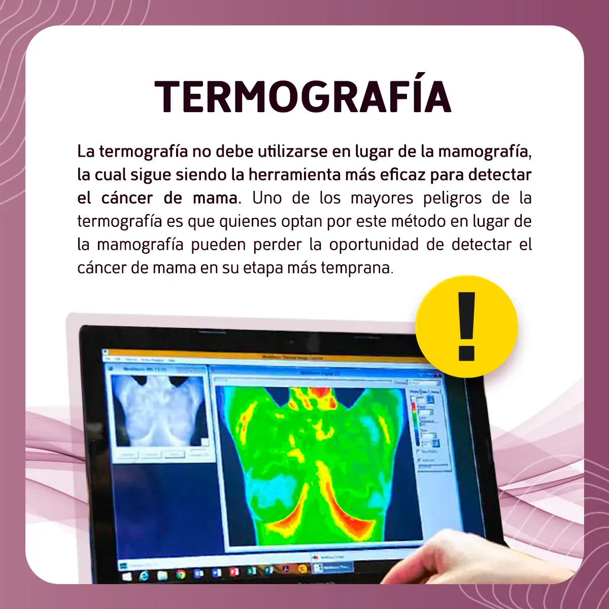 La termografía que diagnostica con rayos infrarrojos el cáncer de mama Técnicas más comunes para diagnosticar cáncer de mama (mastografía, ultrasonido, exploración y biopsia)