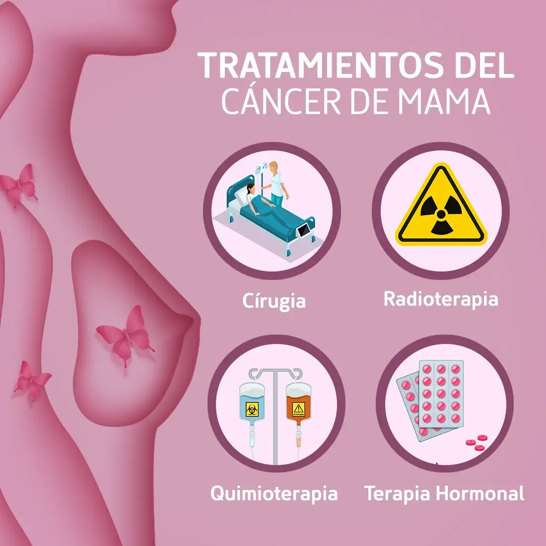 tipos tratamientos del cáncer de mama Tipos de tratamientos del cáncer de mama (cirugía, radioterpia, quimioterapia, terapia hormonal)