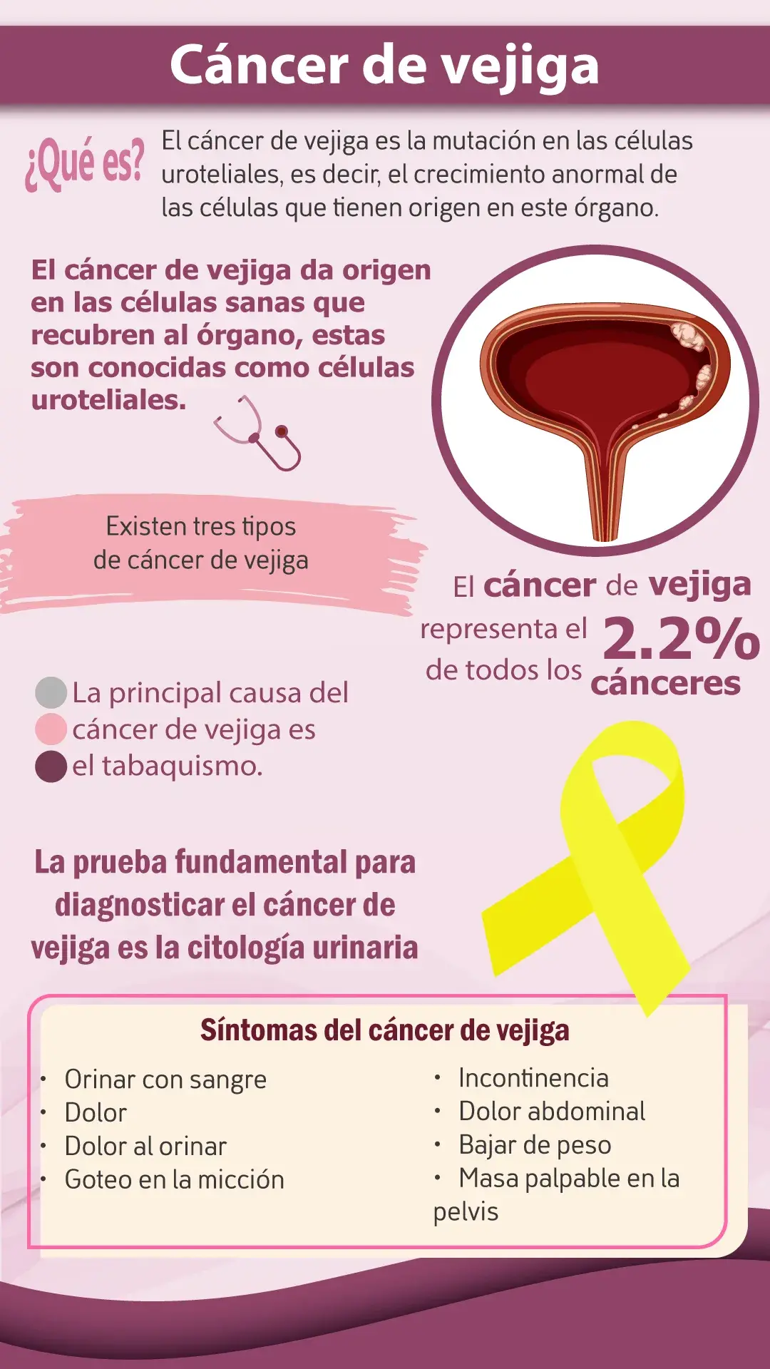 qué es el cáncer de vejiga que es el cáncer de vejiga (origen, tipos, causas y síntomas)