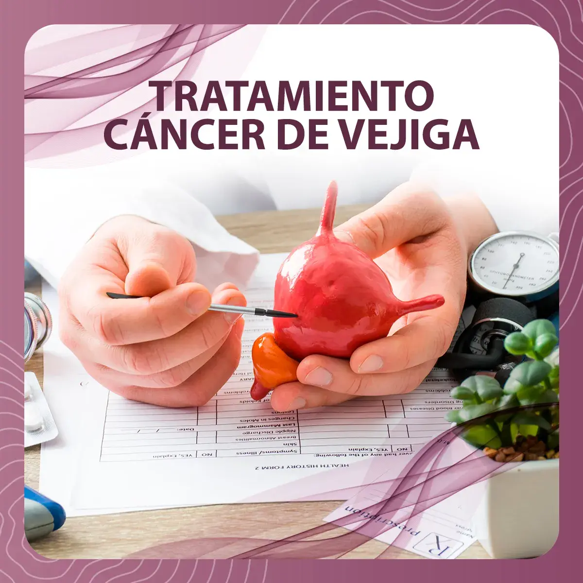 tratamiento para cáncer de vejiga Tratamiento cáncer de vejiga.