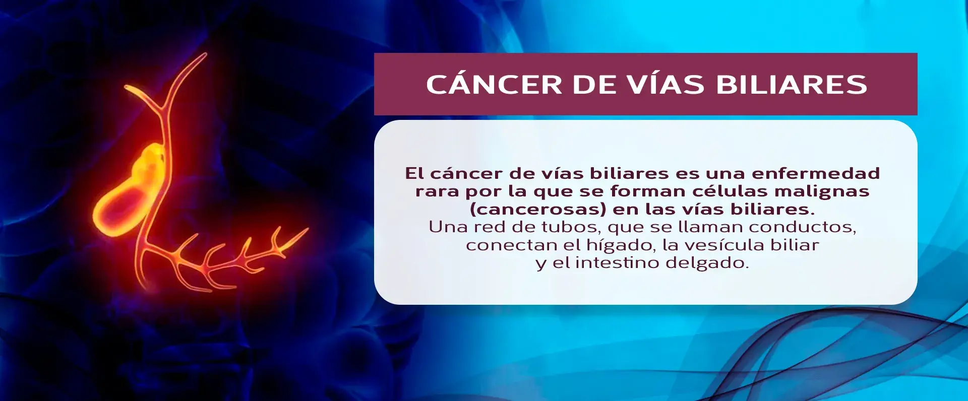 Cáncer de las vías biliares enfermedad rara El cáncer de vías biliares es una enfermedad rara que se da en los conductos del hígado, vesícula biliar e intestino delgado.