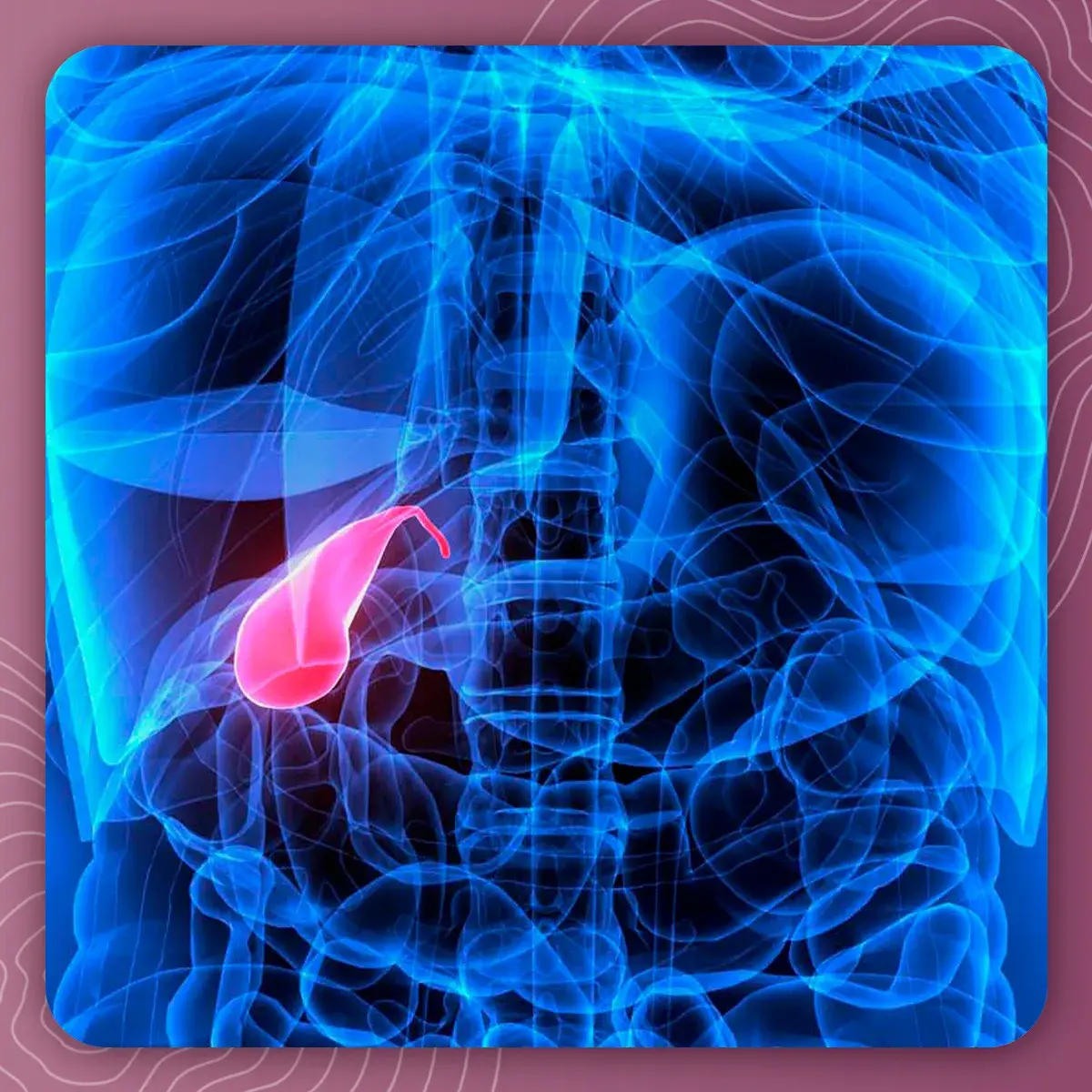 localización de vías biliares La localización de las vías biliares es en la parte superior del abdomen