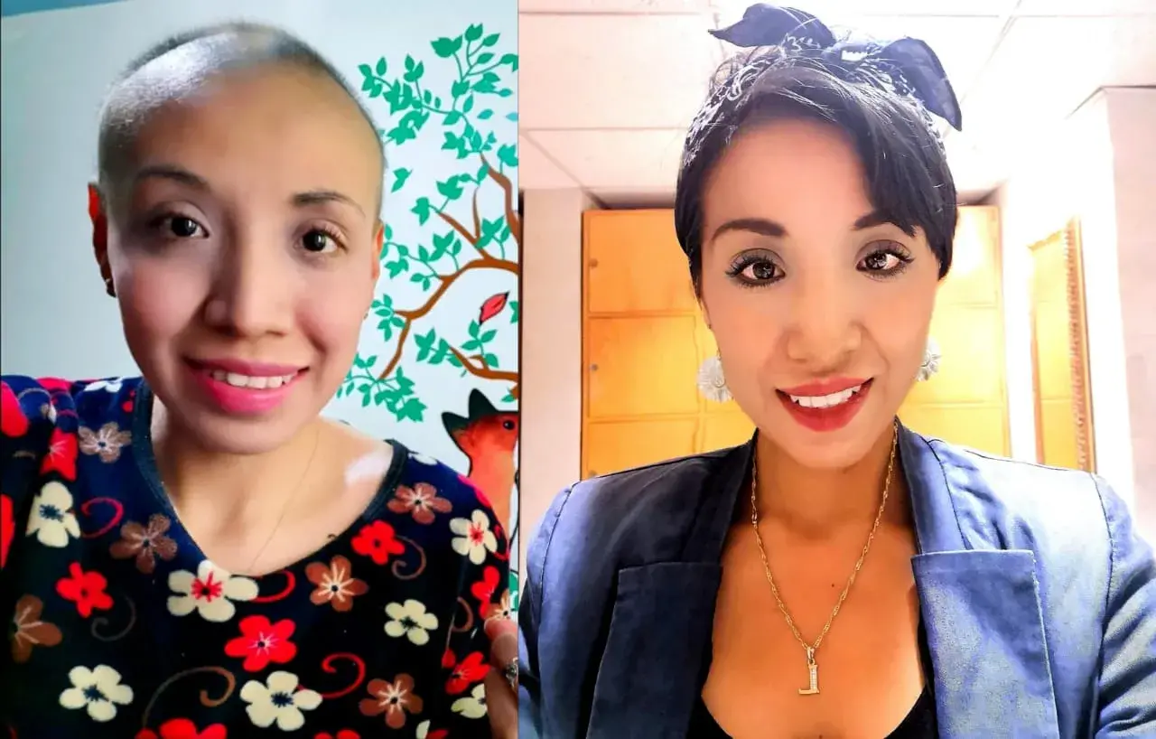 Sobreviviente de cáncer de mama Laura de 35 años que es sobreviviente de cáncer de mama