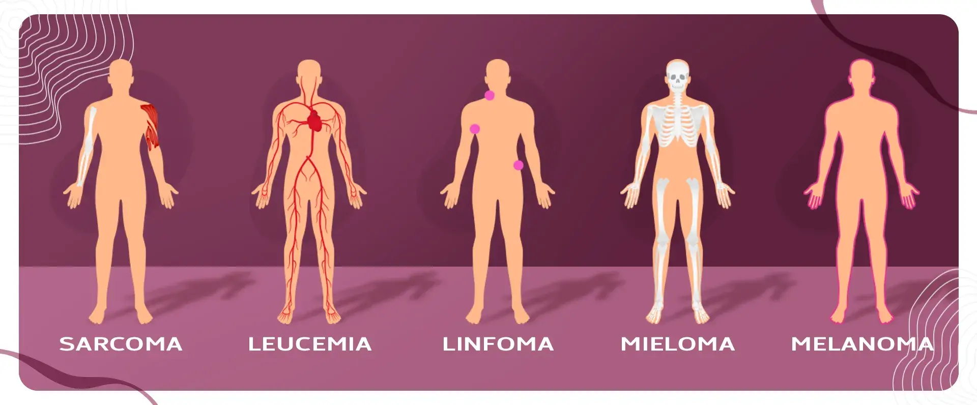 Tejidos que afecta el cáncer El cáncer es considerado como un grupo de enfermedades porque se da en varias partes del cuerpo.s